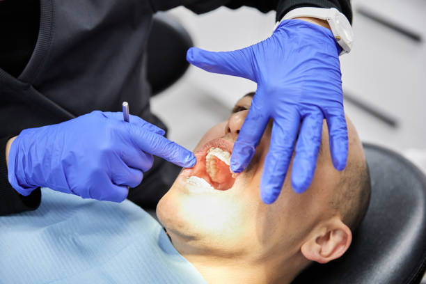 Best Emergency Treatment for Dental Infections or Abscesses in Bethlehem, WV