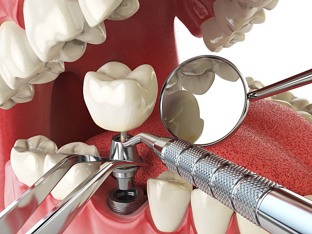 Best Urgent Care for Lost Fillings or Crowns in Bethlehem, WV